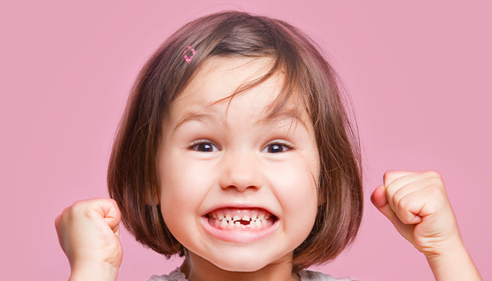 Bác sĩ chỉ ra thời điểm vàng nên bắt đầu chỉnh nha tăng trưởng và điều trị các vấn đề về răng cho trẻ - Ảnh 2.