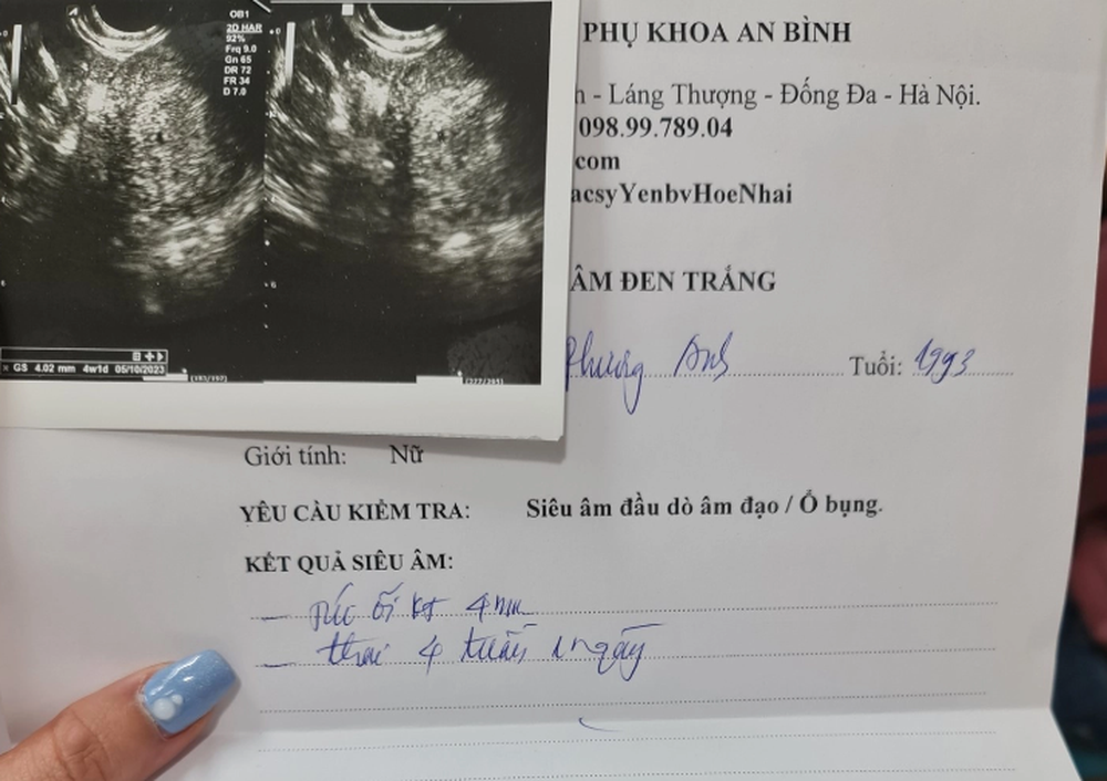 Vụ người phụ nữ bị đánh sảy thai khi đi ăn tối: Nếu xác định được hành vi có tính chất côn đồ thì sẽ bị xử lý hình sự - Ảnh 1.