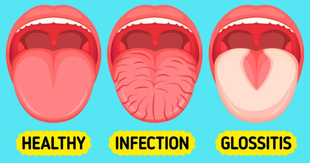 6 mẹo đơn giản giúp bạn chăm sóc răng miệng sạch sẽ - Ảnh 2.