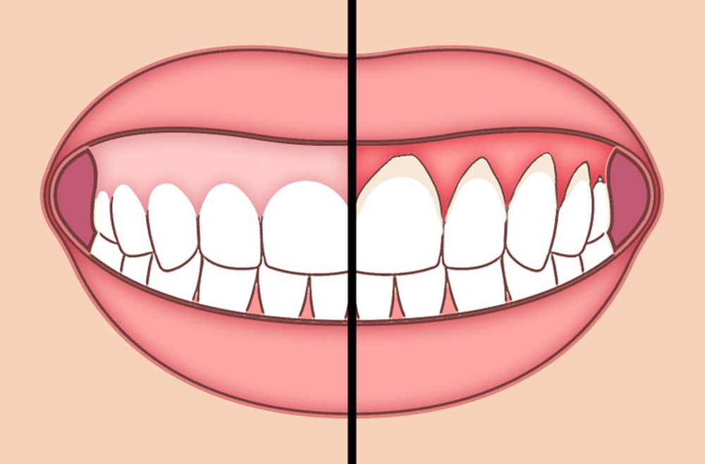 6 mẹo đơn giản giúp bạn chăm sóc răng miệng sạch sẽ - Ảnh 1.
