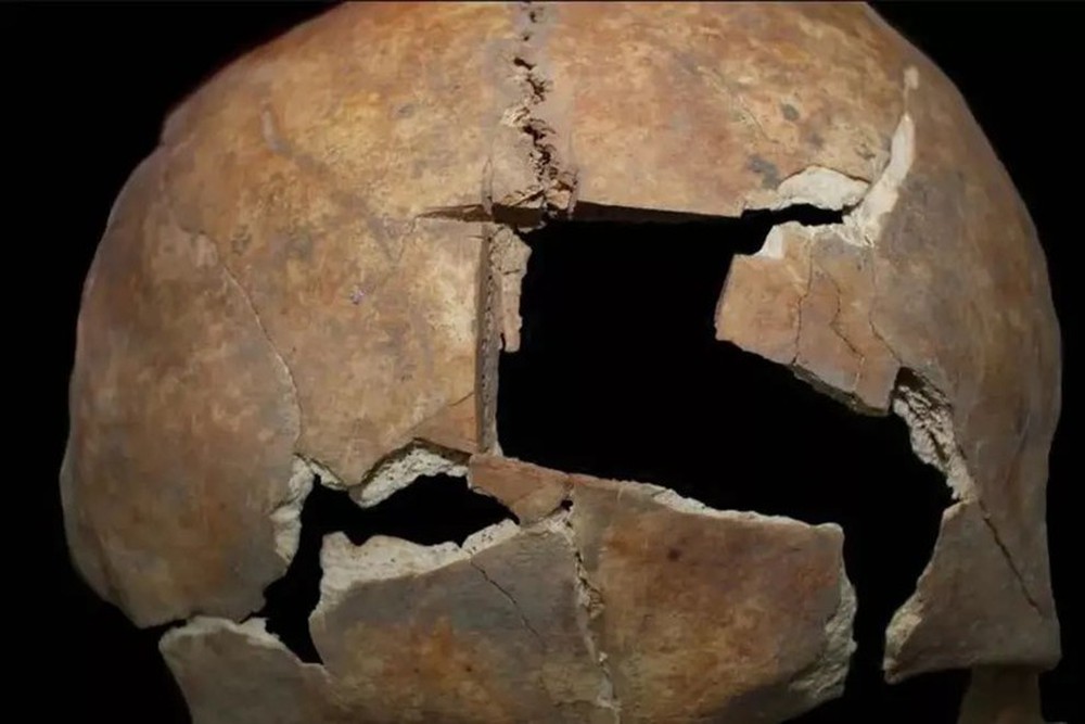 Ngôi mộ chôn cất người đàn ông đã phẫu thuật não từ 3.000 năm trước? - Ảnh 1.