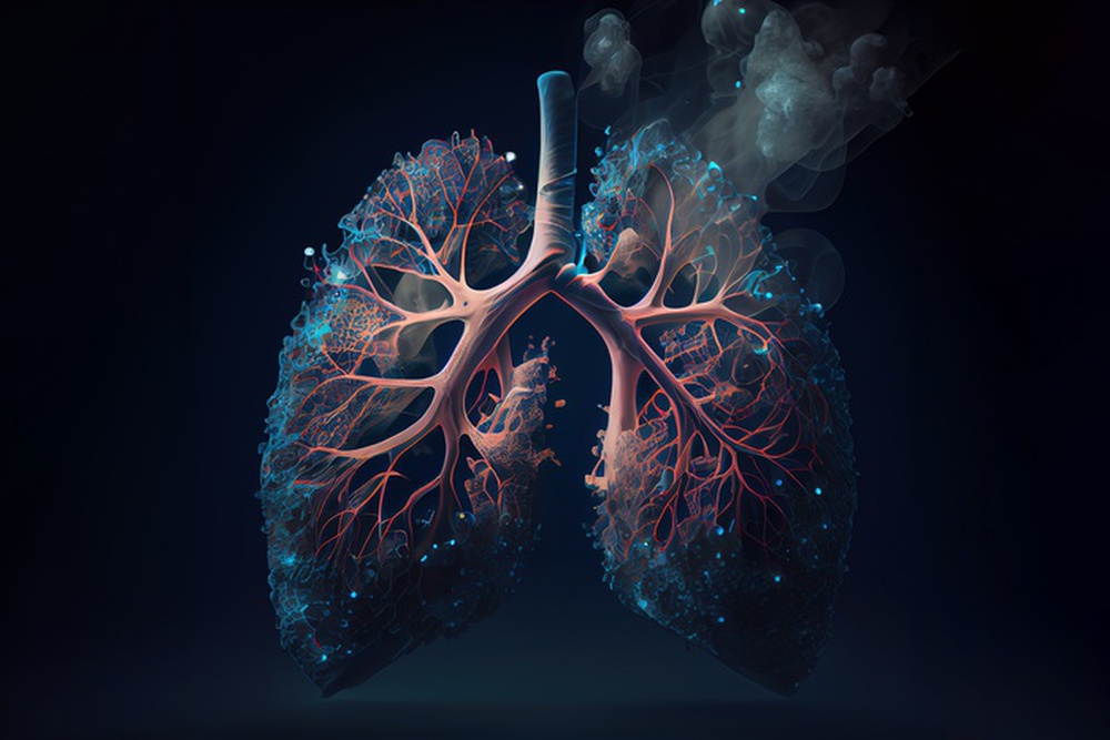 3 triệu chứng nghiêm trọng cảnh báo ung thư phổi - Ảnh 3.