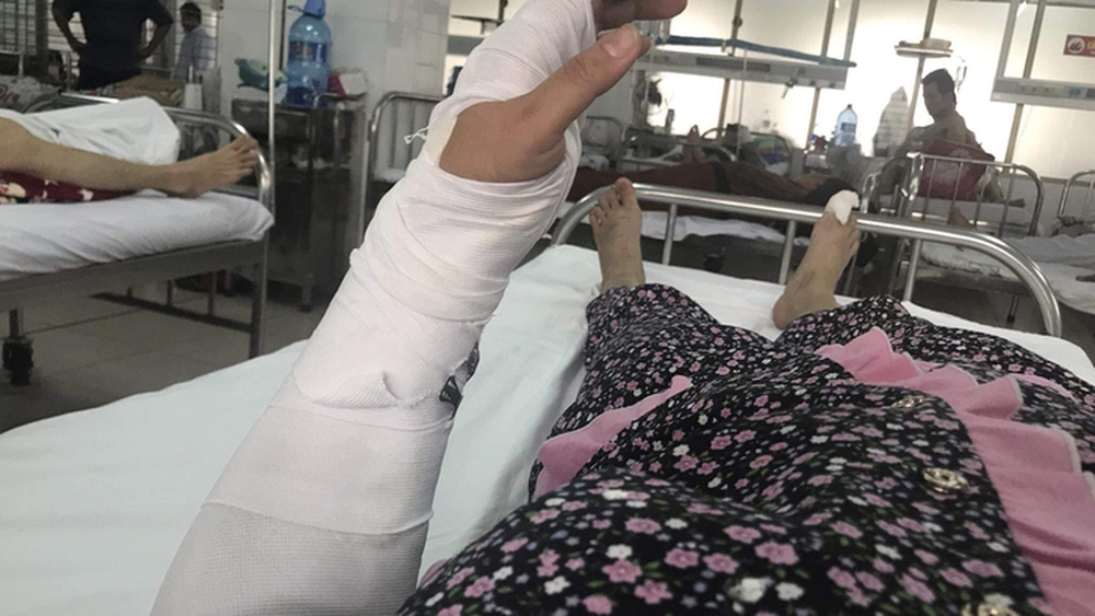 Người phụ nữ bị chồng đánh ở Đà Nẵng: Tôi đã cầu xin nhưng anh ta không dừng lại - Ảnh 2.