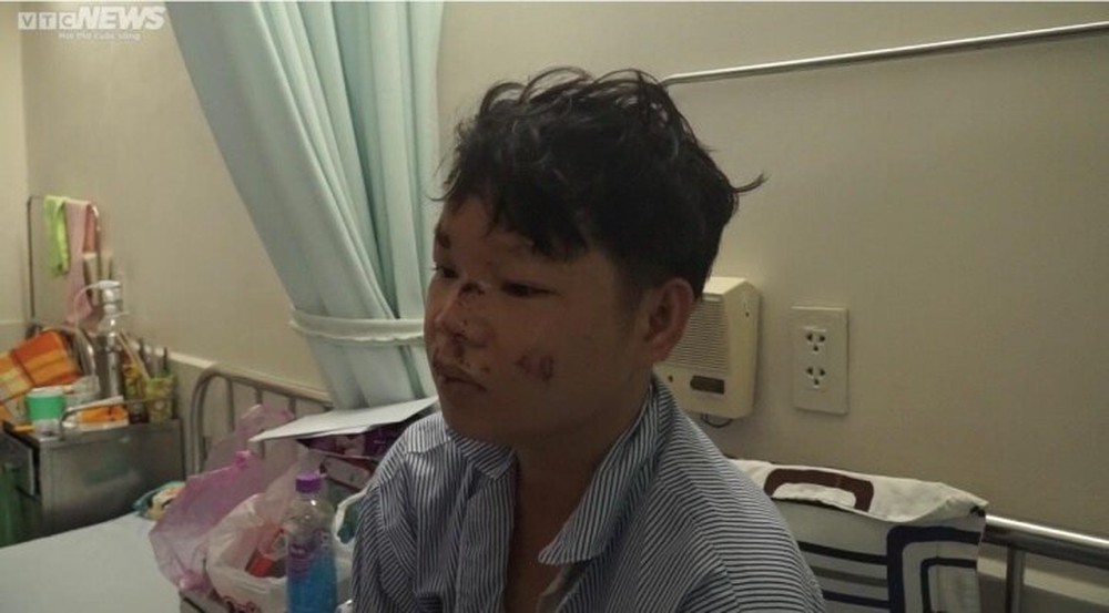 Lời kể của tài phụ vụ lật xe chở dưa ở Phú Yên khiến 9 người thương vong - Ảnh 2.