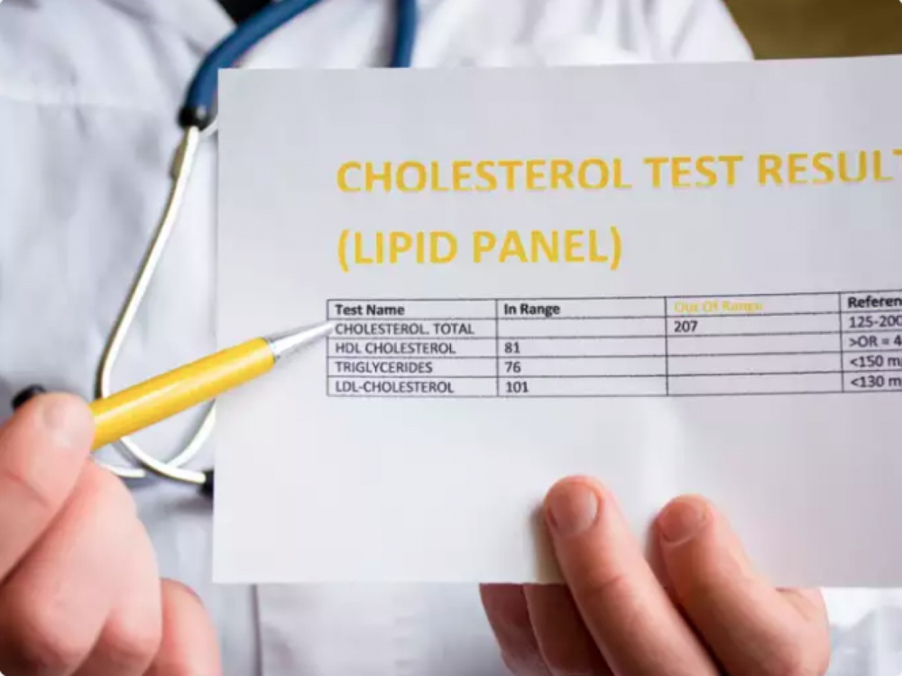 Dấu hiệu ở chân cảnh báo cholesterol cao mà bạn cần đi khám ngay - Ảnh 3.