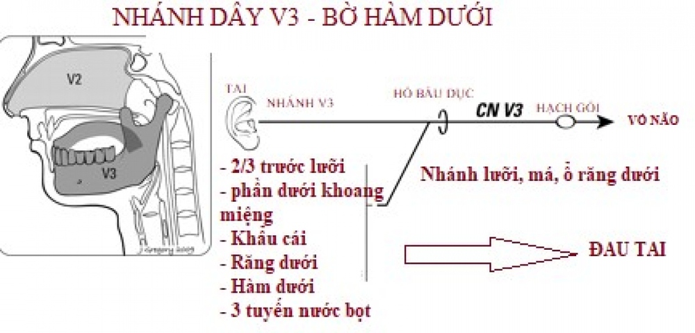 Lưu ý đau tai rất có thể là dấu hiệu của ung thư vùng họng - Ảnh 2.