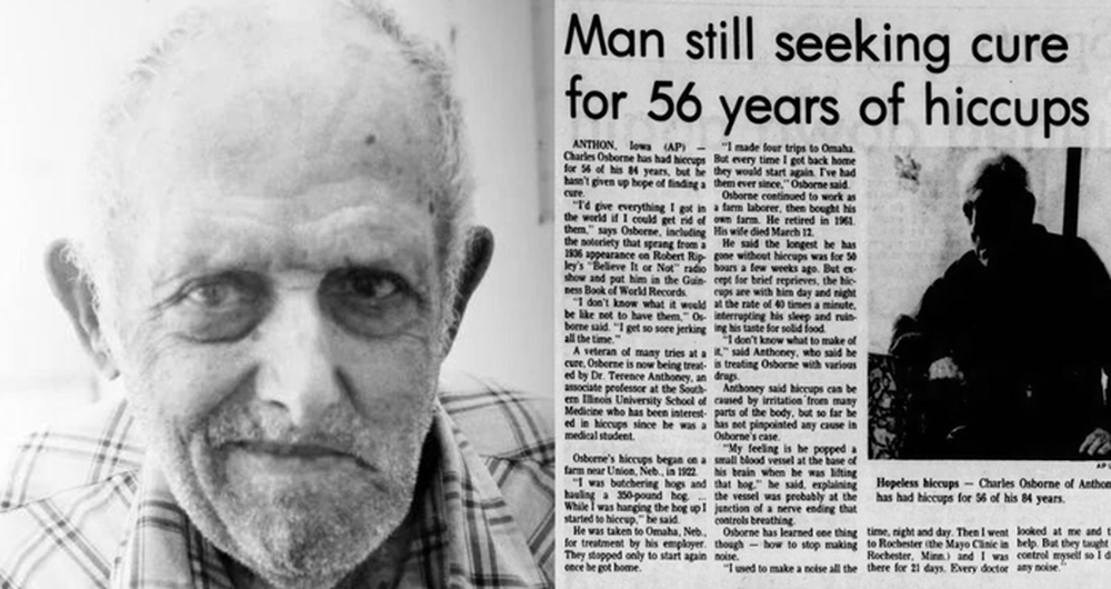 Sau một cú ngã, người đàn ông bị nấc cụt dai dẳng suốt 68 năm - Ảnh 2.