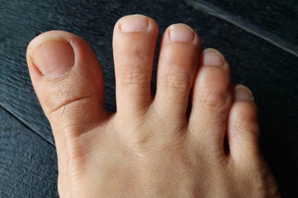 14 loại mùi hôi báo hiệu sự bất ổn của cơ thể - Ảnh 6.