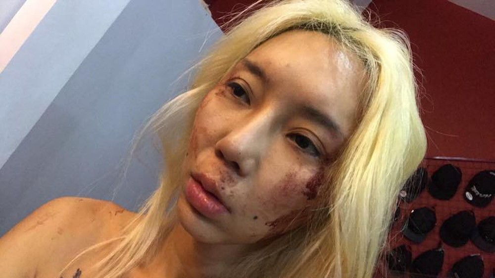 Bị bạn trai đánh đập, nữ DJ nổi tiếng livestream cầu cứu - Ảnh 3.
