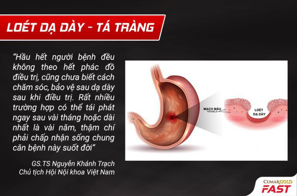 Sự thật ít ai biết để tránh tái phát viêm loét dạ dày - Ảnh 1.