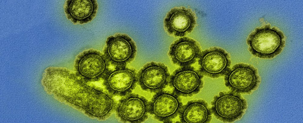 Ngày càng nhiều virus chết người lan ra khắp thế giới, và lý do thật chẳng dễ chịu chút nào - Ảnh 2.