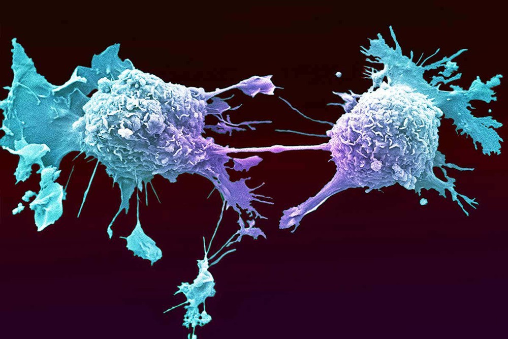 Cải thiện hệ miễn dịch là thuốc chống ung thư tốt nhất: Cơ thể sẽ tự tiêu diệt tế bào xấu - Ảnh 2.