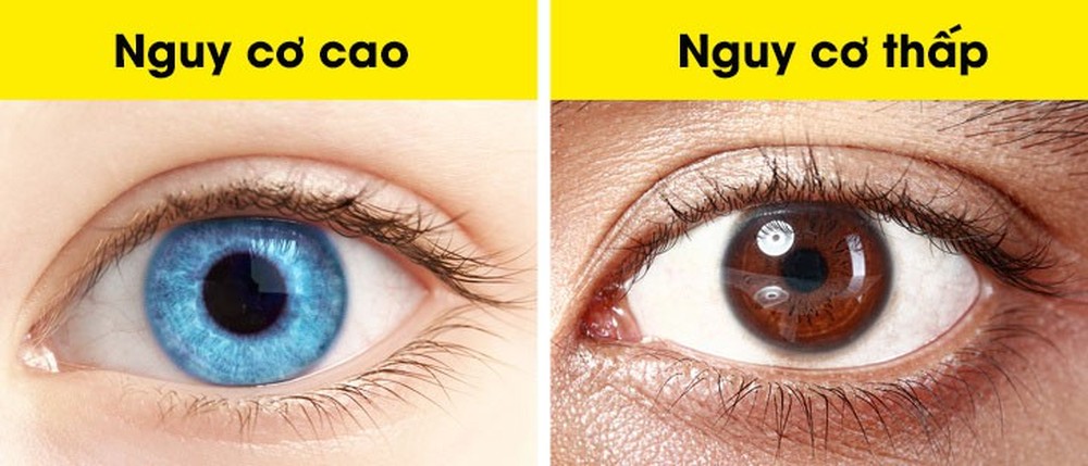 Đọc vị tính cách và sức khỏe qua ngoại hình: Dự đoán khối u ác tính qua đôi mắt - Ảnh 5.