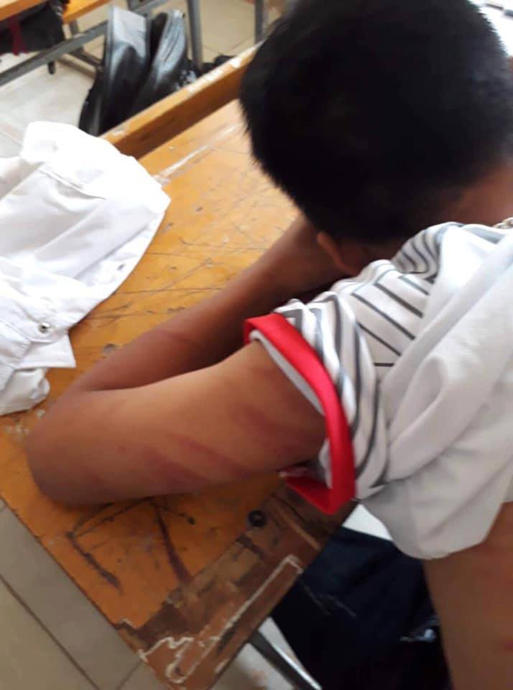 [NÓNG] Học sinh lớp 8 đến trường với cơ thể chằng chịt vết thương, nói bị bố đánh - Ảnh 3.