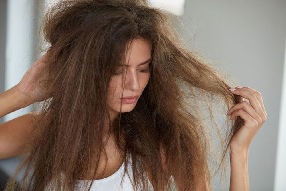 Rụng tóc nhiều có phải tình trạng đáng lo và nguyên nhân do đâu? - Ảnh 2.