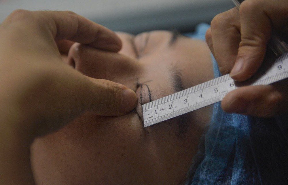 Những cô gái đập mặt xây lại ở Trung Quốc: Đời sang trang nhờ diện mạo mới đến nỗi xem bác sĩ thẩm mỹ là cha mẹ thứ 2 - Ảnh 2.