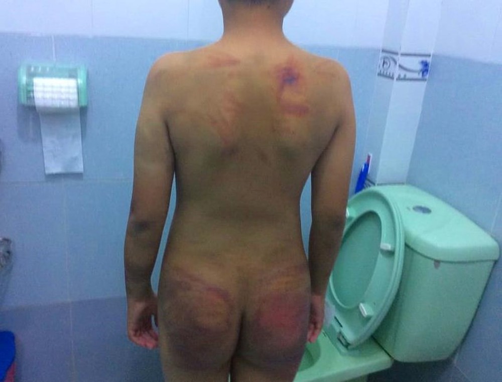 Bé trai 11 tuổi bị 1 người tu hành đánh dã man - Ảnh 5.