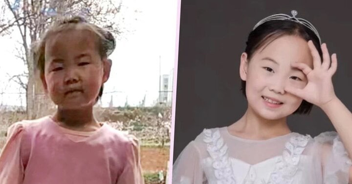 'Cô bé chấy rận' cau có lột xác thành thiên thần nhờ tình yêu của mẹ kế