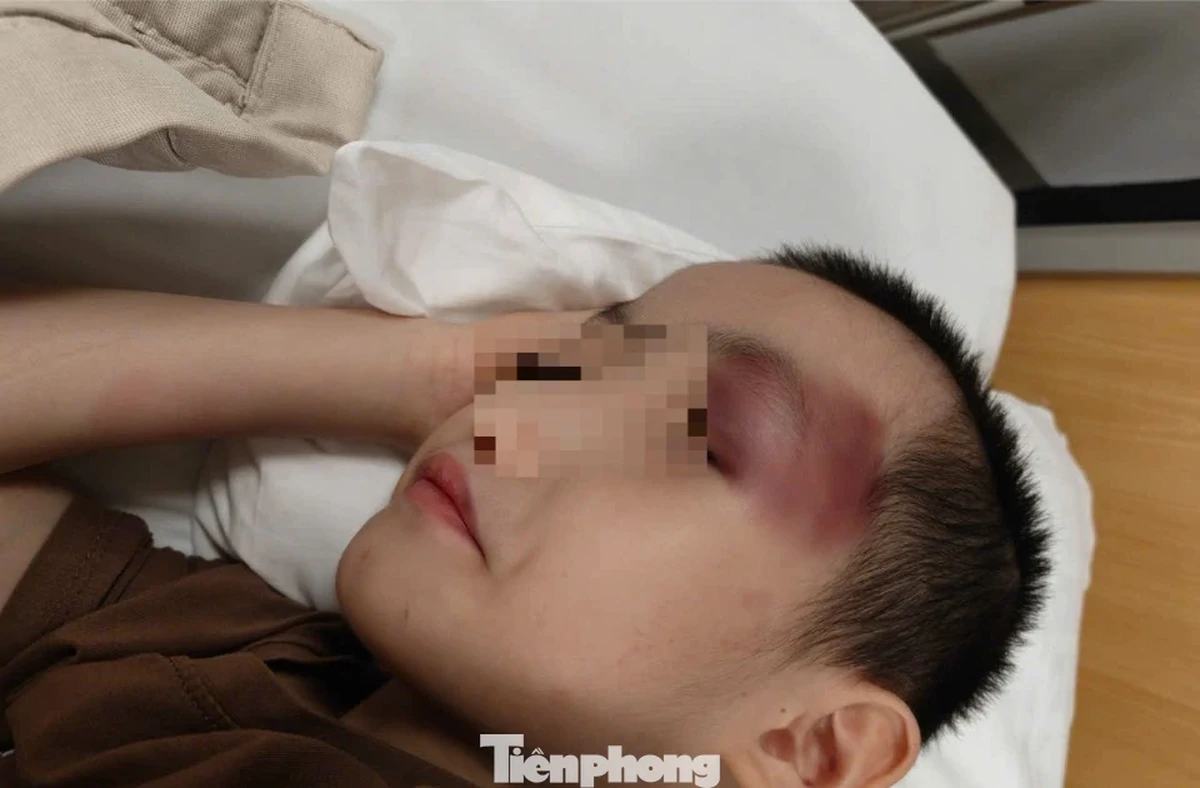 Thông tin mới vụ bé trai 6 tuổi bị chấn thương sọ não khi gửi tại cơ sở can thiệp