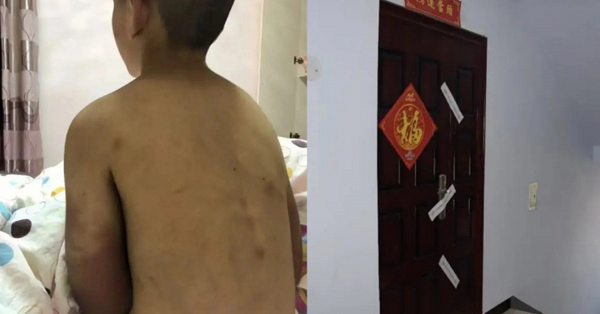 Bi kịch của cậu bé 14 tuổi vẫn phải mặc tã