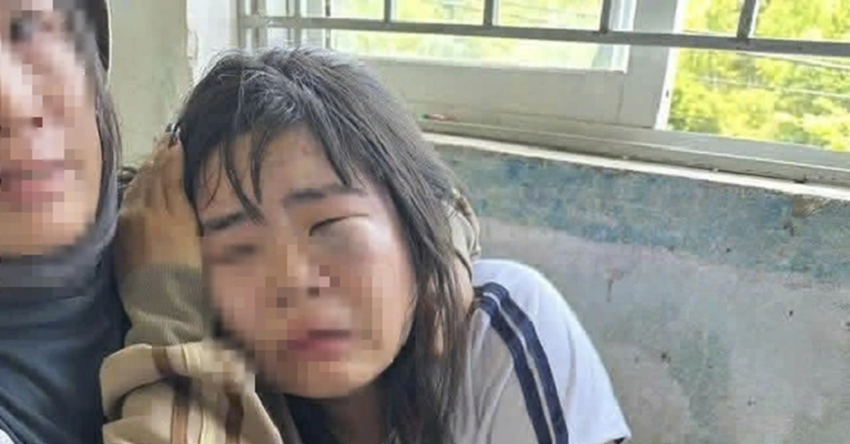 Nữ sinh lớp 7 bị nhóm nam sinh chặn đánh ở cổng trường, phải nhập viện cấp cứu