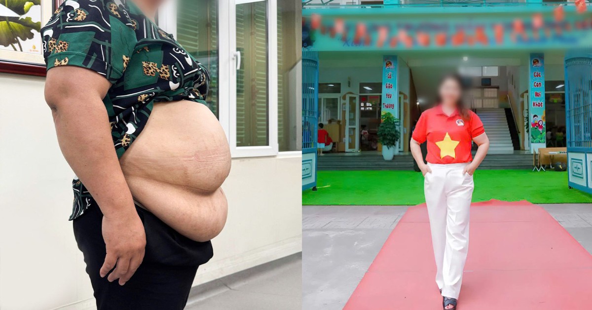 Bị từ chối hút mỡ vì quá béo, cô giáo mầm non 101kg “lột xác” theo cách không ngờ