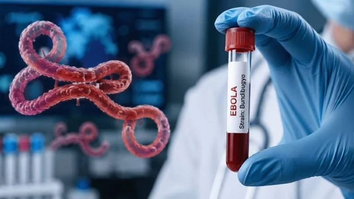 Bộ Y tế kích hoạt giám sát dich Ebola, tăng cường ngăn dịch xâm nhập