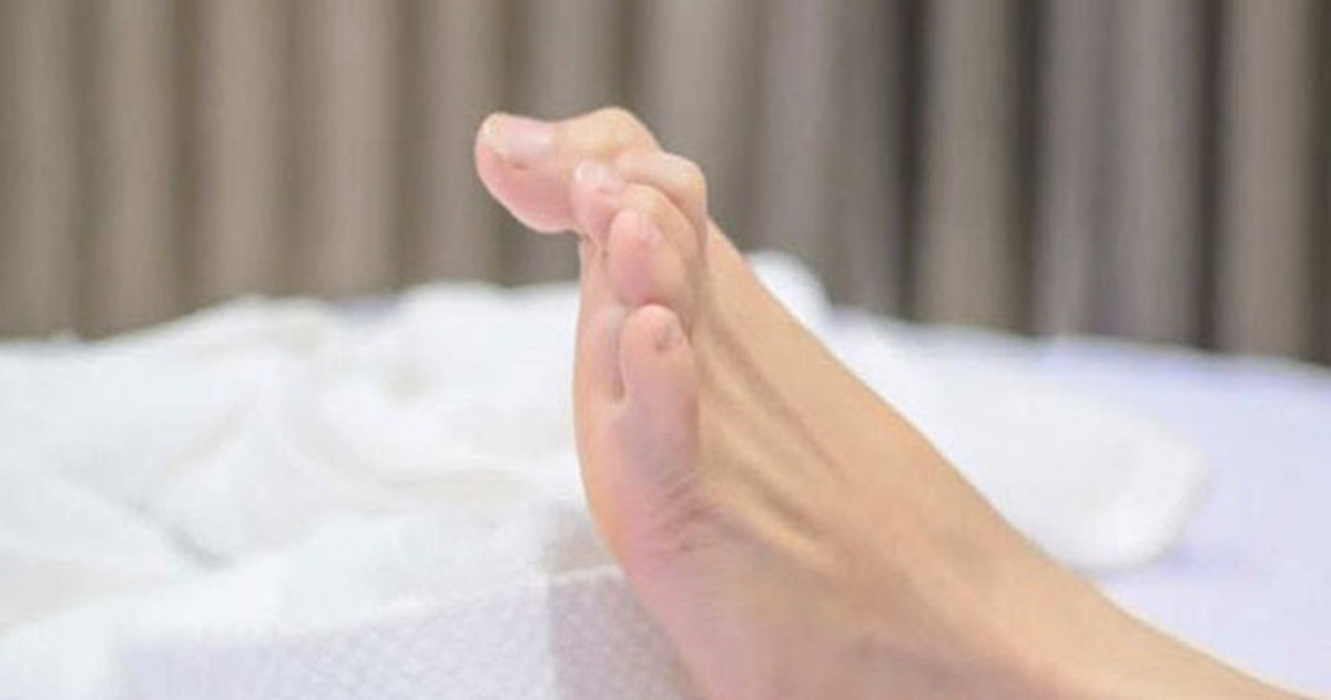 Bác sĩ lý giải hiện tượng chuột rút: Nguyên nhân và cách xử lý