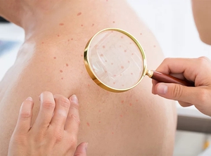 2 Người Đàn Ông Rủ Nhau Đi Khám, Cùng Phát Hiện Nhiễm Hiv: 2 Hành Vi Này Chính Là Nguyên Nhân - Ảnh 3.