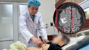 3 đồ uống &acirc;m thầm "t&agrave;n ph&aacute;" n&atilde;o bộ: Nhiều người trẻ đang v&ocirc; tư uống hằng ng&agrave;y - Ảnh 3.