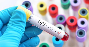1 th&agrave;nh phố ghi nhận hơn 3.000 ca nhiễm HIV mới trong 9 th&aacute;ng đầu năm 2025: 81% l&acirc;y qua con đường n&agrave;y - Ảnh 2.