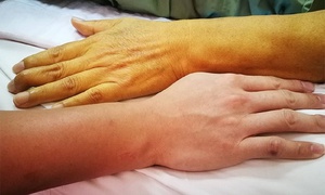 Gan bị mỡ 'xâm chiếm' sẽ phát ra 5 dấu hiệu này, đừng dại mà bỏ qua - Ảnh 2.