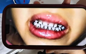 Không phải rau muống xào tỏi, món ăn quốc dân này mới là cái tên lọt top 100 ngon nhất Đông Nam Á - Ảnh 6.