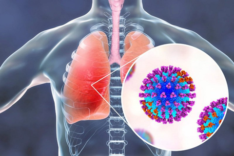 Chuyên gia hướng dẫn cách phòng tránh bội nhiễm vi khuẩn sau mắc Adenovirus - Ảnh 2. Chuyên gia hướng dẫn cách phòng tránh bội nhiễm vi khuẩn sau mắc Adenovirus - Ảnh 2.
