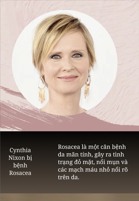 Sao phim 