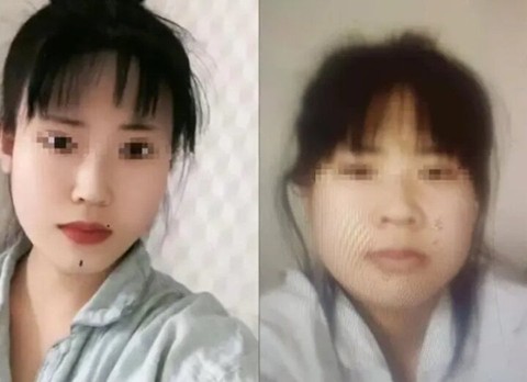 Thất vọng với kết quả phẫu thuật thẩm mỹ, cô gái nhảy sông ngay khi xuất viện- Ảnh 1. Thất vọng với kết quả phẫu thuật thẩm mỹ, cô gái nhảy sông ngay khi xuất viện- Ảnh 1.