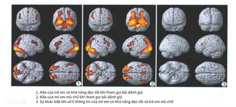 Bộ não của trẻ chăm chỉ đọc với không đọc có sự khác biệt cực lớn: Không lưu ý, 10 năm sau cha mẹ mới ngỡ ngàng- Ảnh 1. Bộ não của trẻ chăm chỉ đọc với không đọc có sự khác biệt cực lớn: Không lưu ý, 10 năm sau cha mẹ mới ngỡ ngàng- Ảnh 1.