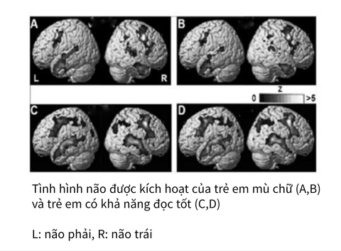 Bộ não của trẻ chăm chỉ đọc với không đọc có sự khác biệt cực lớn: Không lưu ý, 10 năm sau cha mẹ mới ngỡ ngàng- Ảnh 2. Bộ não của trẻ chăm chỉ đọc với không đọc có sự khác biệt cực lớn: Không lưu ý, 10 năm sau cha mẹ mới ngỡ ngàng- Ảnh 2.