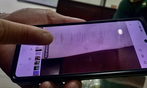 Nhức nhối nạn buôn người - Kỳ 1: Ký ức của thiếu nữ trở về từ 'động quỷ'- Ảnh 2. Nhức nhối nạn buôn người - Kỳ 1: Ký ức của thiếu nữ trở về từ 'động quỷ'- Ảnh 2.