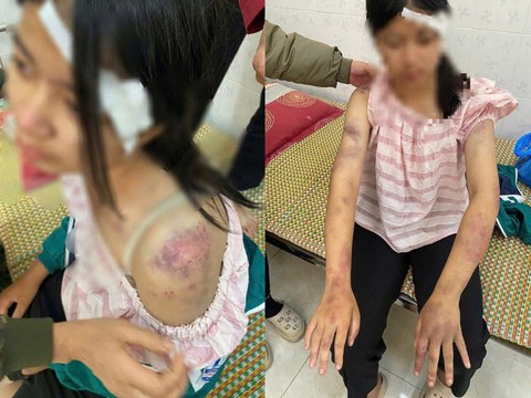 Mẹ bé gái bị bạo hành ở Thái Nguyên: Con bị đánh suốt 4 tiếng, dọa rút móng tay- Ảnh 2.