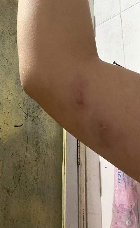 Công an xác minh vụ nữ sinh đi làm thêm bị đồng nghiệp hành hung nhập viện vì tranh cãi "tiền bo" ở Hà Nội - Ảnh 3. Công an xác minh vụ nữ sinh đi làm thêm bị đồng nghiệp hành hung nhập viện vì tranh cãi "tiền bo" ở Hà Nội - Ảnh 3.
