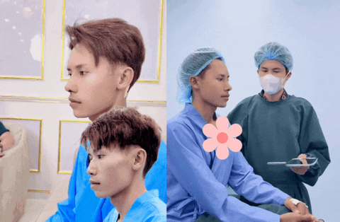 "Dao kéo" cả gương mặt chưa đủ, chàng trai hot nhất Nam vương Campuchia tiếp tục phẫu thuật đôi mắt "thương hiệu"? - Ảnh 2. "Dao kéo" cả gương mặt chưa đủ, chàng trai hot nhất Nam vương Campuchia tiếp tục phẫu thuật đôi mắt "thương hiệu"? - Ảnh 2.