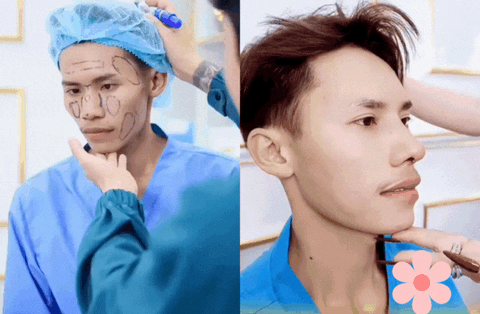 "Dao kéo" cả gương mặt chưa đủ, chàng trai hot nhất Nam vương Campuchia tiếp tục phẫu thuật đôi mắt "thương hiệu"? - Ảnh 3. "Dao kéo" cả gương mặt chưa đủ, chàng trai hot nhất Nam vương Campuchia tiếp tục phẫu thuật đôi mắt "thương hiệu"? - Ảnh 3.