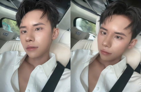 "Dao kéo" cả gương mặt chưa đủ, chàng trai hot nhất Nam vương Campuchia tiếp tục phẫu thuật đôi mắt "thương hiệu"? - Ảnh 6. "Dao kéo" cả gương mặt chưa đủ, chàng trai hot nhất Nam vương Campuchia tiếp tục phẫu thuật đôi mắt "thương hiệu"? - Ảnh 6.