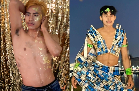 "Dao kéo" cả gương mặt chưa đủ, chàng trai hot nhất Nam vương Campuchia tiếp tục phẫu thuật đôi mắt "thương hiệu"? - Ảnh 7. "Dao kéo" cả gương mặt chưa đủ, chàng trai hot nhất Nam vương Campuchia tiếp tục phẫu thuật đôi mắt "thương hiệu"? - Ảnh 7.