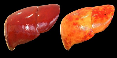 Người đàn ông 45 tuổi 
