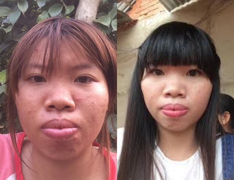 Lột xác sau thẩm mỹ, cô gái từng bị gọi là Thị Nở tái sinh muốn tham gia chương trình hẹn hò để tìm một nửa của mình - Ảnh 2. Lột xác sau thẩm mỹ, cô gái từng bị gọi là Thị Nở tái sinh muốn tham gia chương trình hẹn hò để tìm một nửa của mình - Ảnh 2.