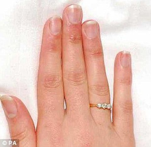 Thoát chết ngoạn mục nhờ chiếc nhẫn đính hôn, bà mẹ trẻ vạch trần kế hoạch chôn sống trong rừng sâu đáng kinh tởm của gã bạn trai độc ác - Ảnh 5. Thoát chết ngoạn mục nhờ chiếc nhẫn đính hôn, bà mẹ trẻ vạch trần kế hoạch chôn sống trong rừng sâu đáng kinh tởm của gã bạn trai độc ác - Ảnh 5.