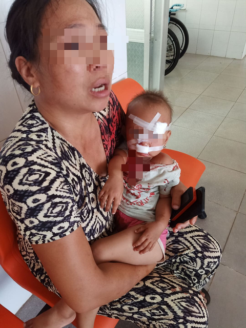 Mẹ bé gái bị cha ruột ném ly vào mặt, khâu 12 mũi: Lúc 13 tháng, con bé cũng bị ném vật cứng làm chấn thương sọ não - Ảnh 1. Mẹ bé gái bị cha ruột ném ly vào mặt, khâu 12 mũi: Lúc 13 tháng, con bé cũng bị ném vật cứng làm chấn thương sọ não - Ảnh 1.