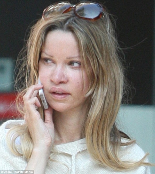 Fresh faced: Alicia Douvall was spotted for the first time after her corrective surgery back in May 